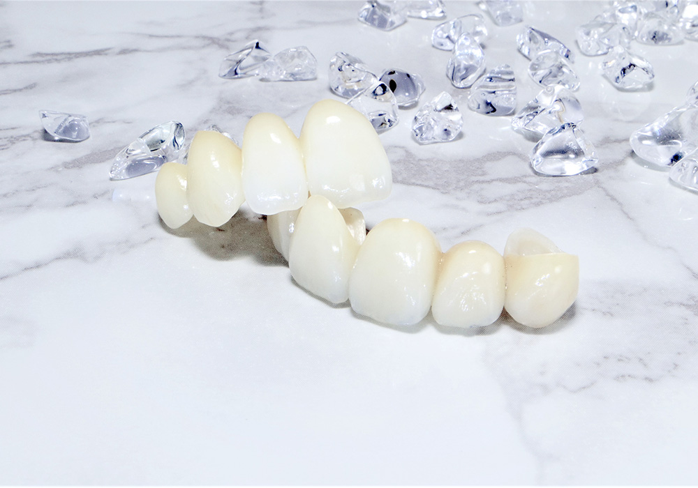 ②セラミックの品質が安定している